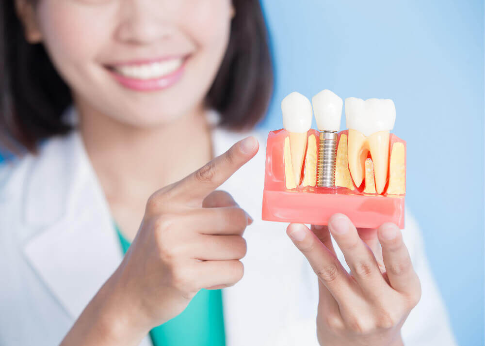 Average Cost of Dental Implants