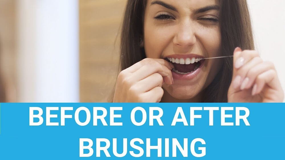 Floss Before or After Brushing - The Right Time to Floss – Franklin ...