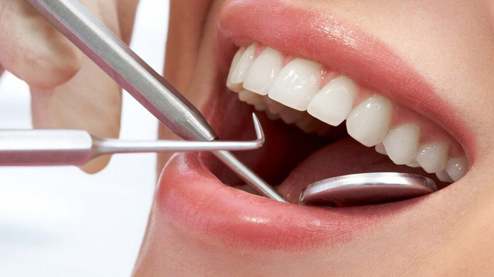 How to Cure Gingivitis in a Week
