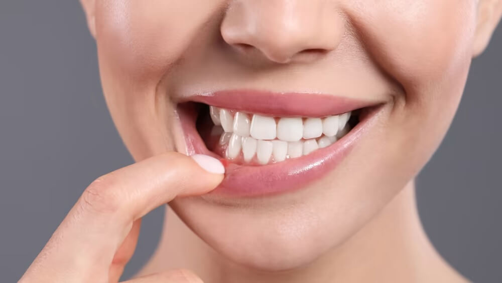 How to Cure Mouth Ulcers Fast Naturally