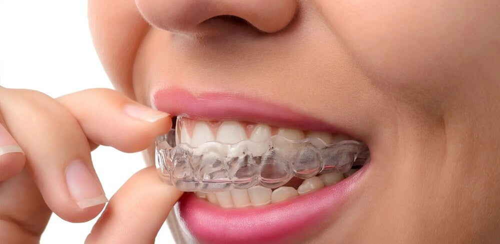 How to Fix a Gap in Your Teeth