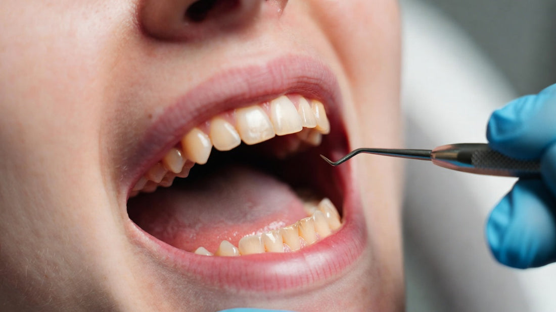 What Is a Pulp Cap in Dental?