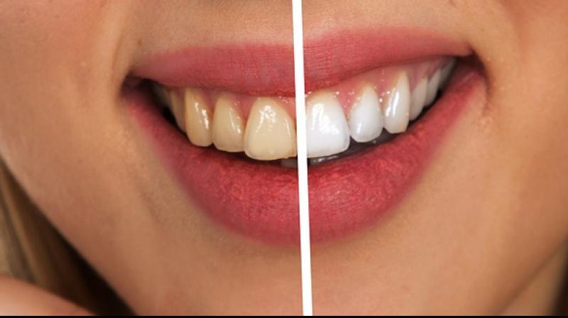 Does Vaping Stain Teeth? - All You Need to Know about Vaping and Oral Health